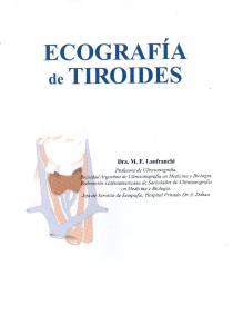 Ecografia de Tiroides